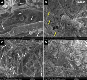 Metabolic modeling of the International Space Station microbiome reveals key microbial interactions.