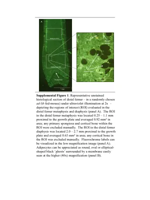 Leptin and environmental temperature as determinants of bone marrow adiposity in female mice